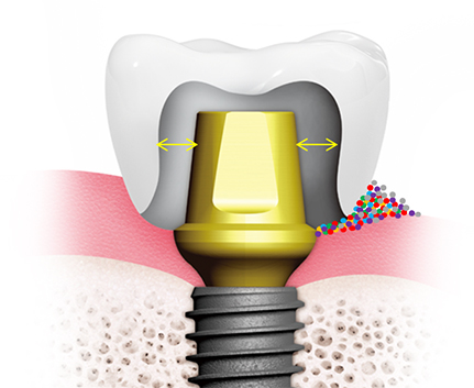 기성 방식 이미지