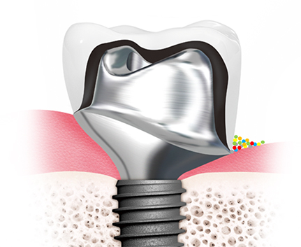 맞춤 지대주 이미지