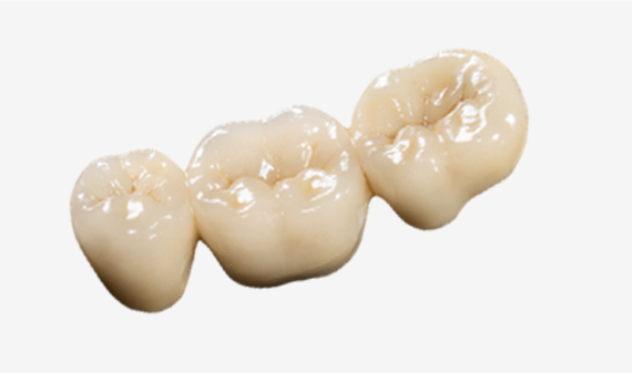 지르코니아 보철물